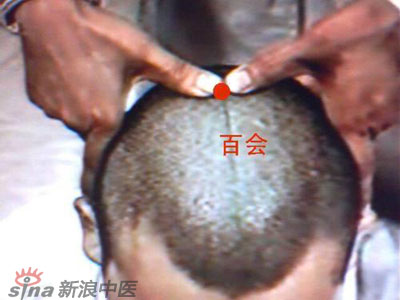 艾灸常用的保健穴有哪些？--百會
