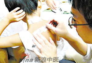灸法的種類  你知道多少？